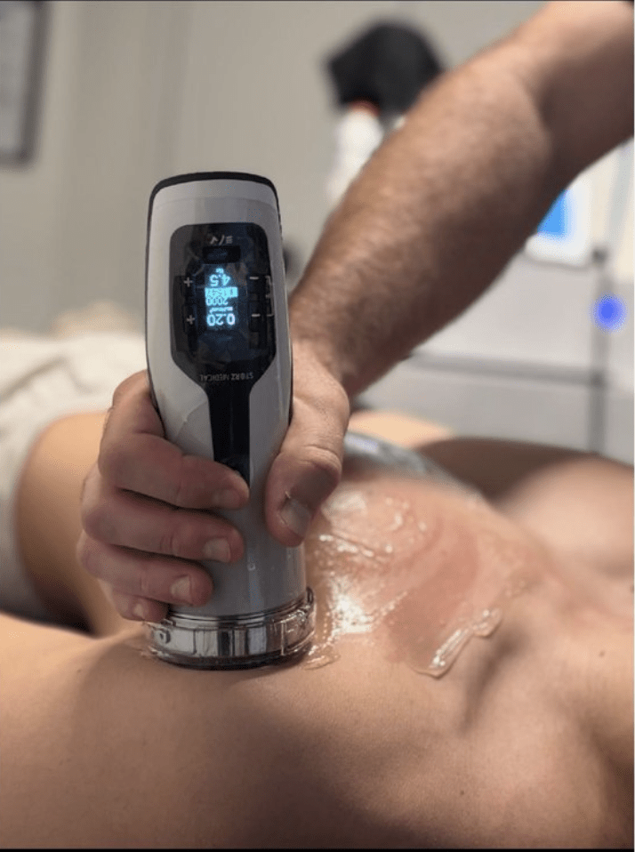 A shockwave therapy treatment session at CityIR